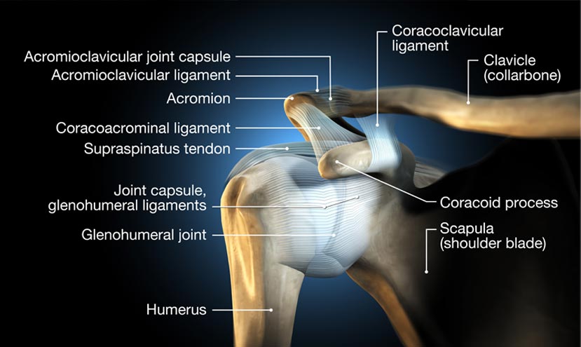 A Superior Labrum Anterior and Posterior tear can cause considerable pain in the shoulder